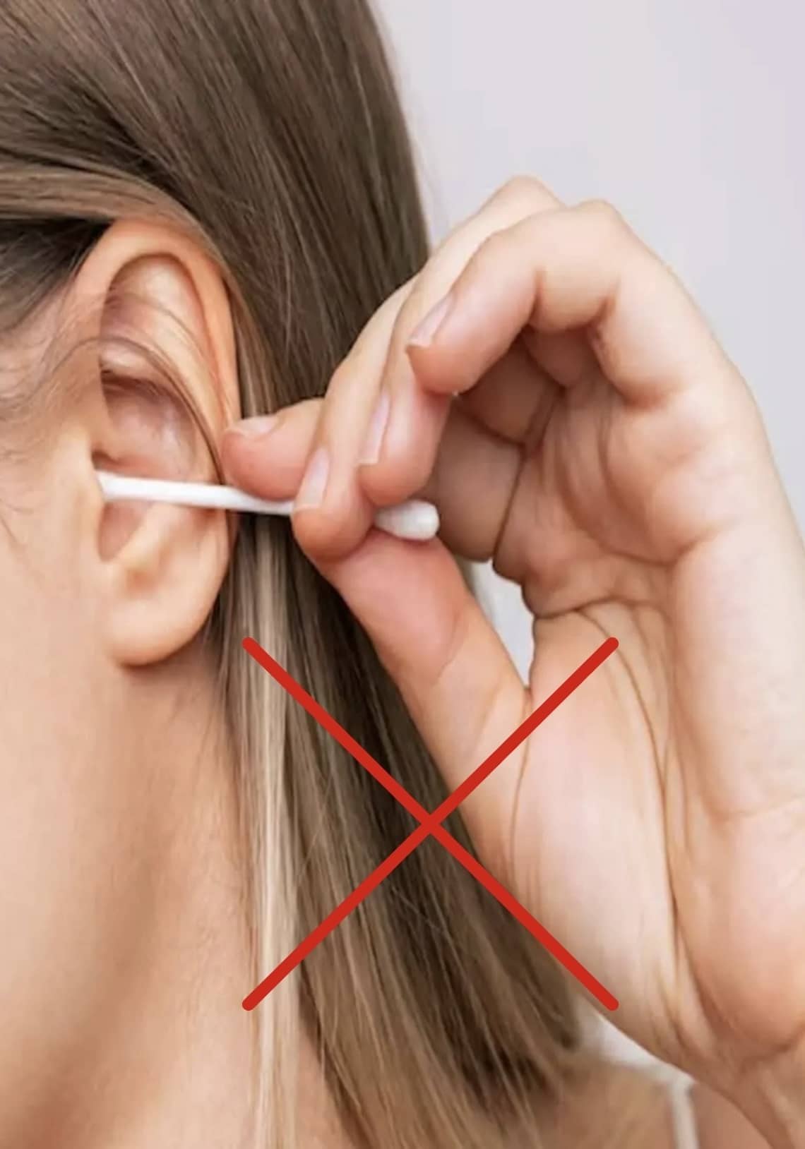 microsuction treatment
